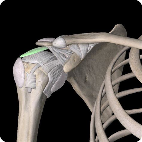 Subacromial Bursitis