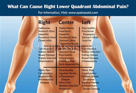 Lower Right Back Pain Female / Lower Back Pain in Women: Causes ...