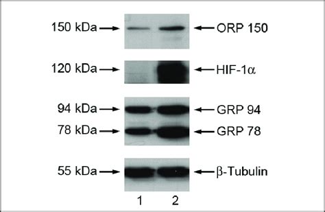 Western immunoblot analysis of ORP 150 (upper panel) and GRP 94 and GRP ...