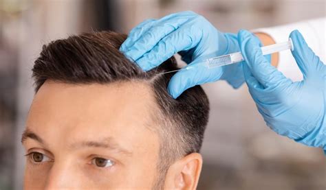 3 Nonsurgical Treatments For Hair Loss Honest Hair Restoration Hair Transplant Specialists