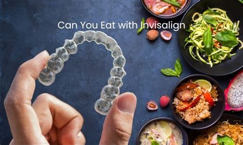 Can You Eat With Invisalign Here Are Our Helpful Tips