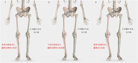 什麼是退化性關節炎？｜吳博貴醫師 病症說明｜臺北榮總關節重建科