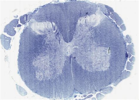 Spinal Cord Meninges Histology