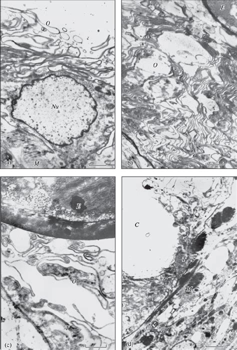 Ultrastructural Organization Of Uterine Epithelium In Clestobothrium