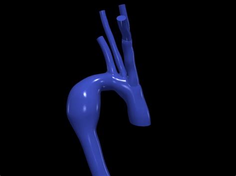 Aorta D Model