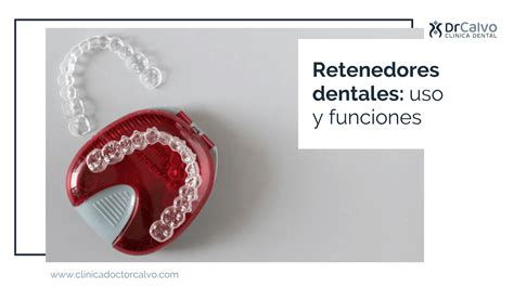 Retenedores dentales uso y funciones Clínica Doctor Calvo