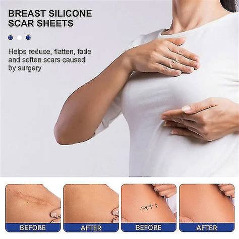 Silicone Scar Sheets Silicone Scar Sheets For Breast 8 Pack Breast