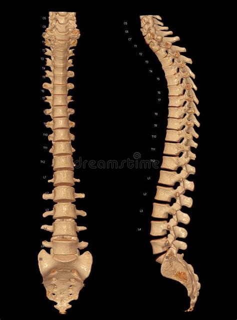 CT Scan Of Whole Spine 3D Rendering Showing Profile Human Spine Stock