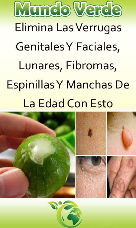 Best 11 ELIMINA LAS VERRUGAS GENITALES Y FACIALES LUNARES FIBROMAS