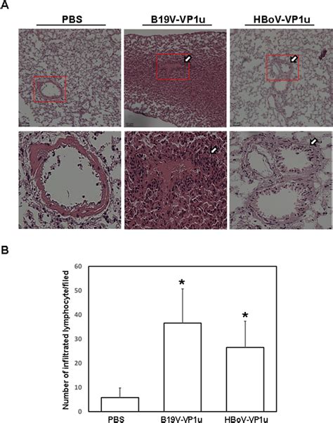 Lymphocyte Infiltration In Lung Tissue Of Balb C Mice Lung Tissues