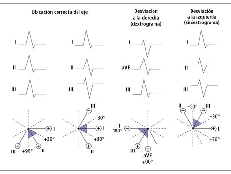 Electrocardiograma Est Ndar Electrocardiograf A Pruebas Funcionales