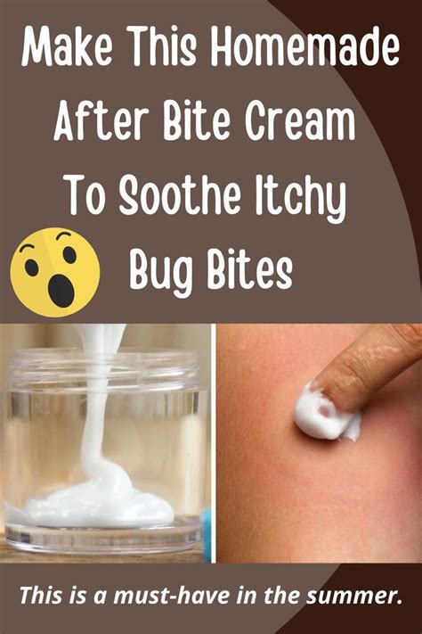 Irritated By A Bug Bite Make This Cream At Home And Get Instant Relief