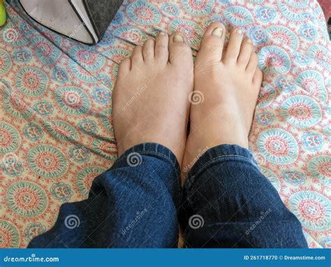 Naked Bare Ugly Toes White Stock Photo Image Of Toes