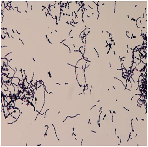 Streptococcus Bovis Scheda Batteriologica Ed Approfondimenti