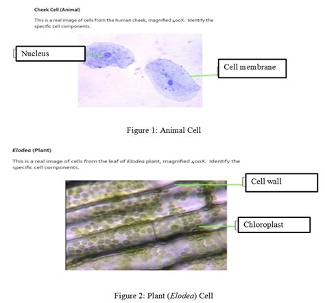 Elodea Cells Under A Microscope