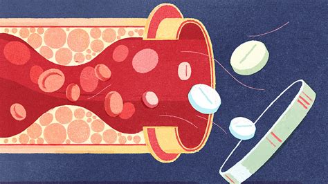 When The Benefits Of Statins Outweigh The Risks The New York Times