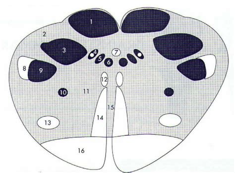 Caudal Medulla Level Of Sensory Decussation Diagram Quizlet