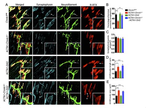 Slit Overexpression Increased Synaptophysin Staining At The Nmj P