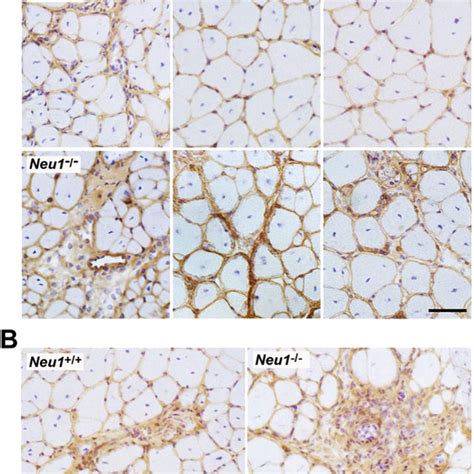 Immunohistochemical Staining For Collagen Iii In Neu And Neu