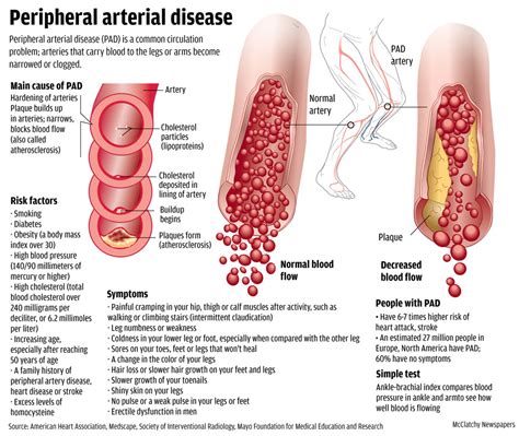 Vascular Cta Diagnostic And Wellness Center