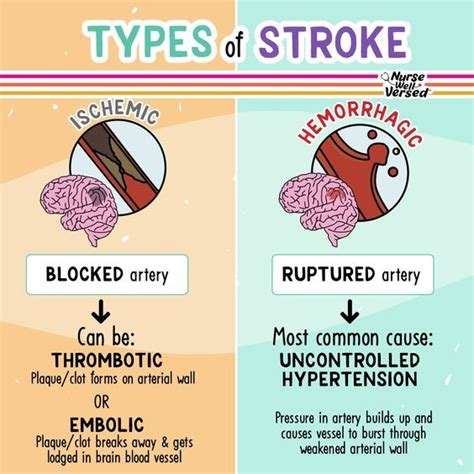 Types Of Strokes Nursingschool Nursingstudent Study Image Credits