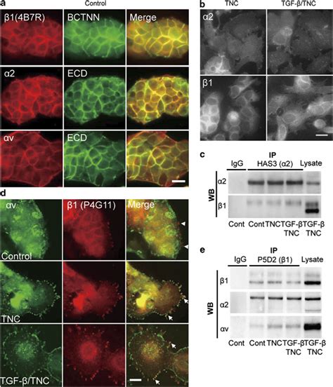 Integrin V Heterodimers But Not Are Mobilized To Focal