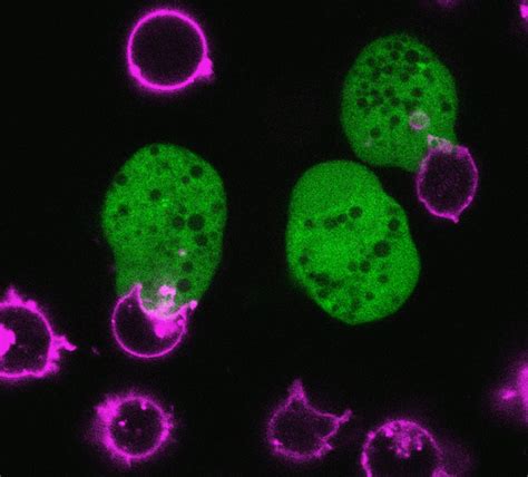 Death by Amoeba, a Nibble at a Time | Science | AAAS