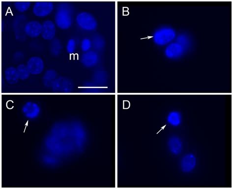 Representative Fluorescence Micrographs Showing Nuclear Morphology Of