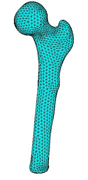 Discretization Of The Reconstructed Femur In A Finite Element Mesh With