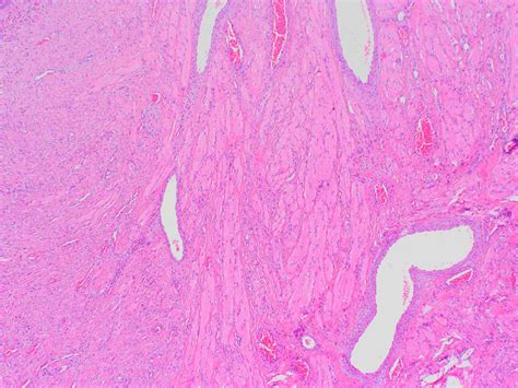 Histology of the specimen. Structure of skeletal muscle tissue ...