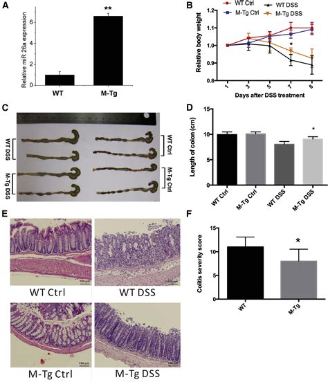 Mir 26a Attenuates Colitis And Colitis Associated Cancer By Targeting