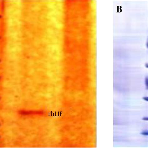 Western Blot Analysis Download Scientific Diagram