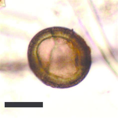 Whipworm Egg Trichuris Trichiura From The Xuanquanzhi Latrine