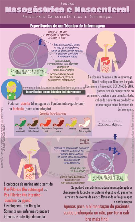Diferença Entre Sonda Nasogastrica E Nasoenteral