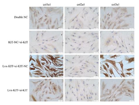 expression levels  collagen cola cola  cola  detected