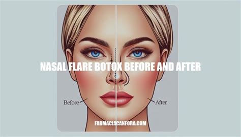 Nasal Flare Botox Before And After Transform Your Facial Symmetry