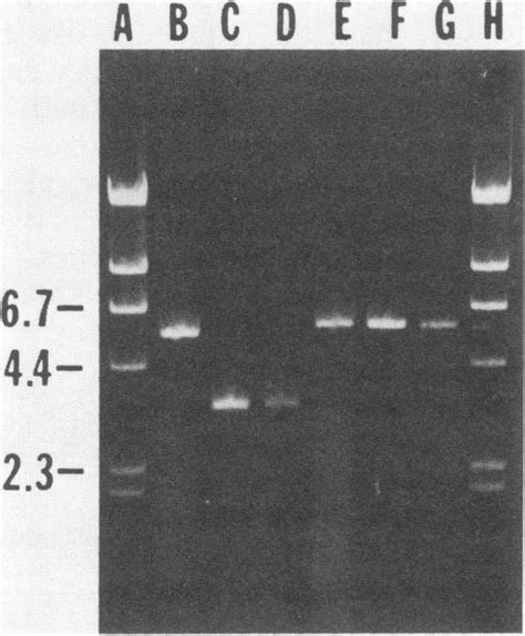 Agarose Gel Electrophoresis Of Group I And Group Ii S Mutans Plasmids