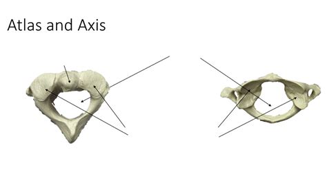 Lab #3 - Axial Skeleton: Axis and Atlas Diagram | Quizlet