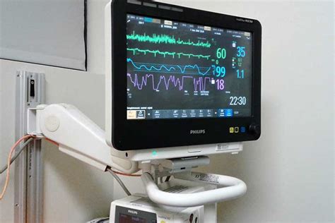 5 Lead Ecg Placement And Cardiac Monitoring Ausmed