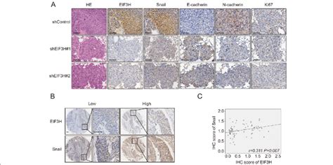 Eif3h And Snail Levels Positively Correlate In Escc A Representative Download Scientific