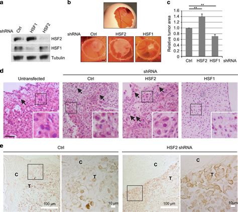 Silencing Of HSF2 Increases In Vivo Tumor Growth In The CAM Model PC3