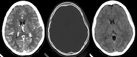 head ct typical scans left   head ct  contrast head ct