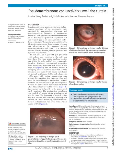 (PDF) Pseudomembranous conjunctivitis: unveil the curtain