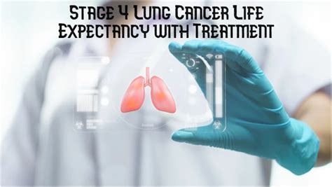 Stage 4 Lung Cancer Life Expectancy with Treatment - World Informs