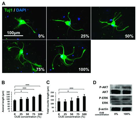 OUBs Promote Neurite Outgrowth In DRG Neurons A Representative