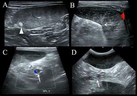 Abdominal Ultrasonography Of The Splenic Parenchyma And Vasculatures Download Scientific