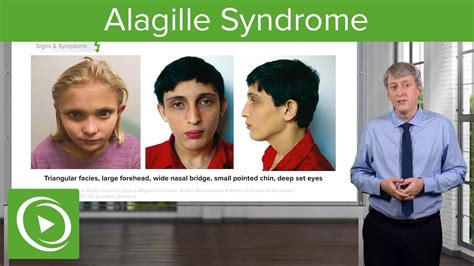 Alagille Syndrome Pediatrics Lecturio Youtube