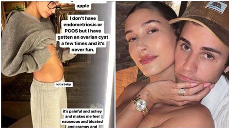 Hailey Bieber Mostra Barriga Inchada E Afasta Boatos De Gravidez N O