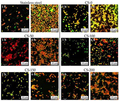 Materials Free Full Text Anodic Electrodeposition Of Chitosan Agnp Composites Using In Situ