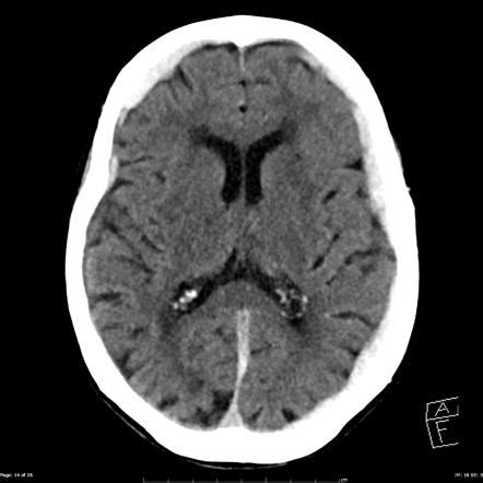 Radiology Quiz Radiopaedia Org Playlist Core Conditions